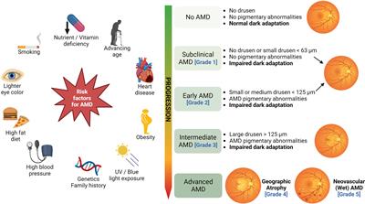 Geographic atrophy: pathophysiology and current therapeutic strategies